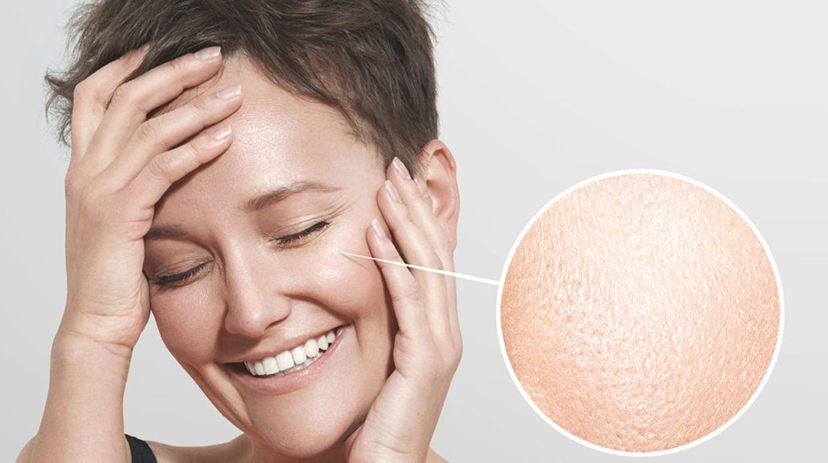 Open Pores Treatment In Mumbai at Mumbai Cosmetic Centre